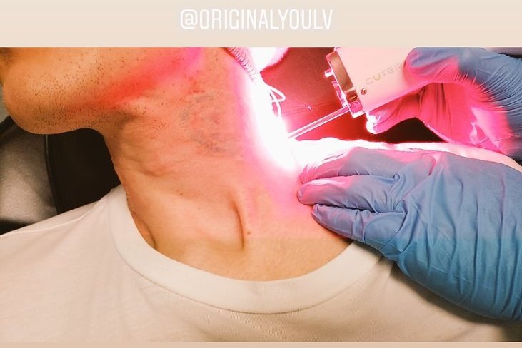 OriginalYouLV's tweet photo. Laser Tattoo Removal...@OriginalYouLV
702-631-5009 https://t.co/1cYZsdxUZB
Reclaim Your Past
#ReclaimYourPast
#tattoo #tattooremoval #tattoos #tattooremovallv #tattooremovalvegas #byeink #happyday #originalyoulv #laserclinic #happy #beyou #stressless https://t.co/UBidTkXwmc