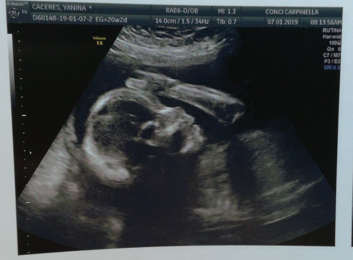 #FelipeLorenzo mí príncipe 👑 pequeño 💙👶