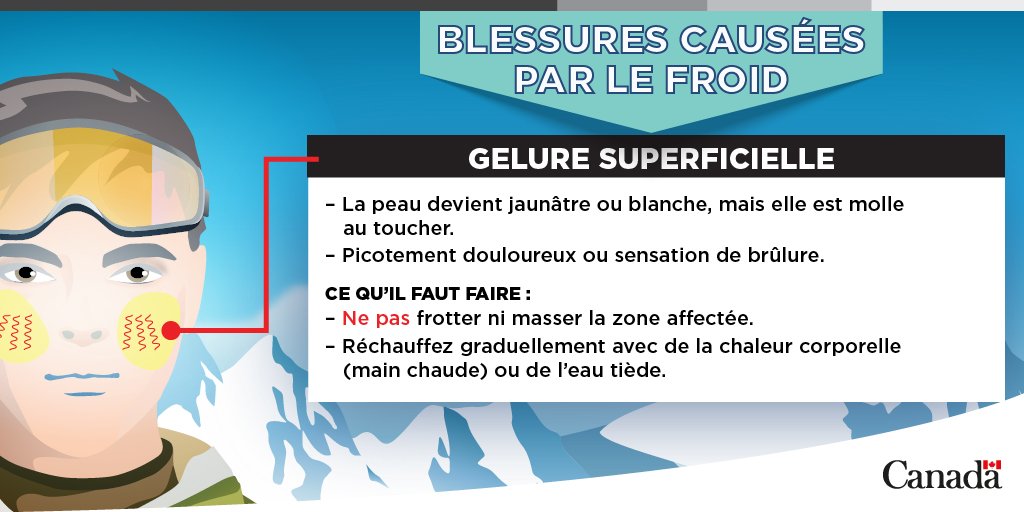 environnementca's tweet photo. Préparez-vous aux conditions de #RefroidissementÉolien et de #TempsFroid lorsque vous passez du temps à l’extérieur.
Restez #MétéoLogique et consultez les prévisions météorologiques avant de sortir.
https://t.co/Q1IzJXdIVr https://t.co/EYuwgUo7qN