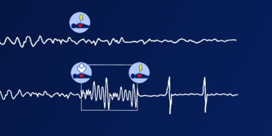 PhilipsFrance's tweet photo. D'ici 2022, tous les ERP seront équipés de #défibrillateur automatisé externe.
Apprenez les gestes qui sauvent dès aujourd'hui : https://t.co/M5zzETTtIW.
Devenez incollable sur l'utilisation d'un défibrillateur automatisé externe pour être toujours prêt(e) à sauver une vie. https://t.co/QdbJFy5s3L