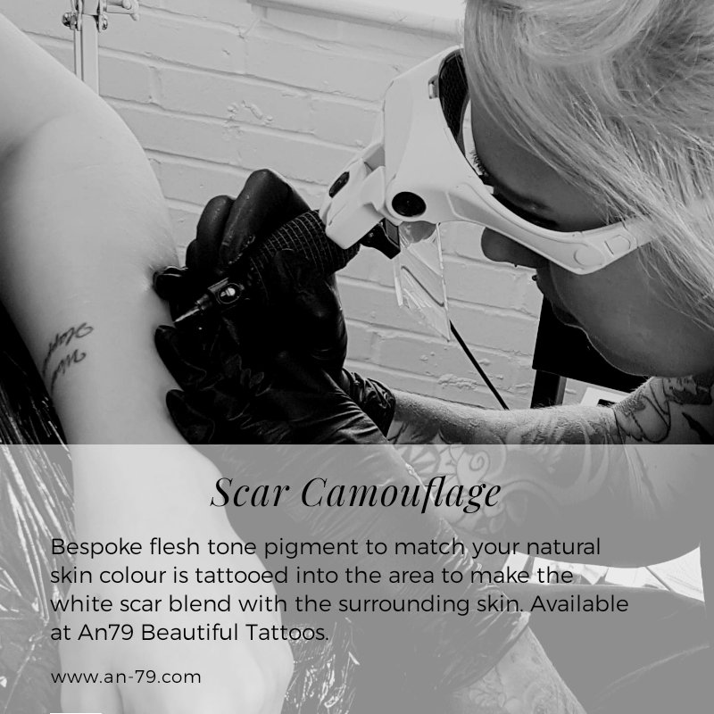 An79Inc's tweet photo. Scar Camouflage at An79 Beautiful Tattoos.

#an79beautiful #scarcamouflage #medicaltattooing #tattoos #medicaltattoos #scars #camouflage #cover #beautifulskin #loveyourskin https://t.co/e9nE5qkRjg