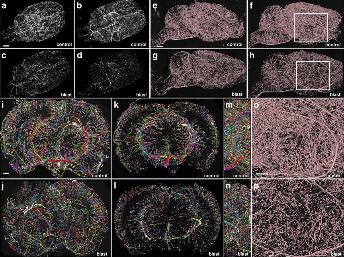 MBFBioscience's tweet photo. 1st #Vesselucida360 paper published by @BMC_series! A tool for #3D auto-reconstruction of #vessel #morphology, VL360 was used to study #microvascular changes occurring from low-level #blasttrauma to further understand #bTBI in #veterans &amp; #activeduty  https://t.co/cNcNLtZCYX https://t.co/MfkOFacyCr