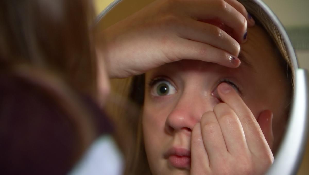 NBCDFW's tweet photo. Doctors say children as young as six can wear contact lenses: https://t.co/U16ltYv4Tx
#HealthConnection https://t.co/Ij5Qczbwnx