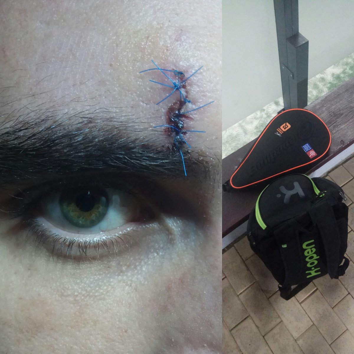 LifeNHobby's tweet image. Herida cerrada? Pues a jugar de nuevo!!! Además, el look de muñeco de trapo le hace pensar al rival hasta dónde estás dispuesto a llegar para sacar una bola 😂 #livensport #livesport #padel