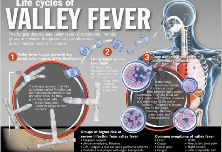 immunodiseases's tweet photo. Greater Awareness of #ValleyFever Needed Nationally :The symptoms of Valley fever are similar to those of other common #illnesses,which may cause  delay in diagnosing  and treating especially in the kids of age 1-5.
Every Researcher is Unique &amp; we adore their Research work better https://t.co/eey7LtTlgA