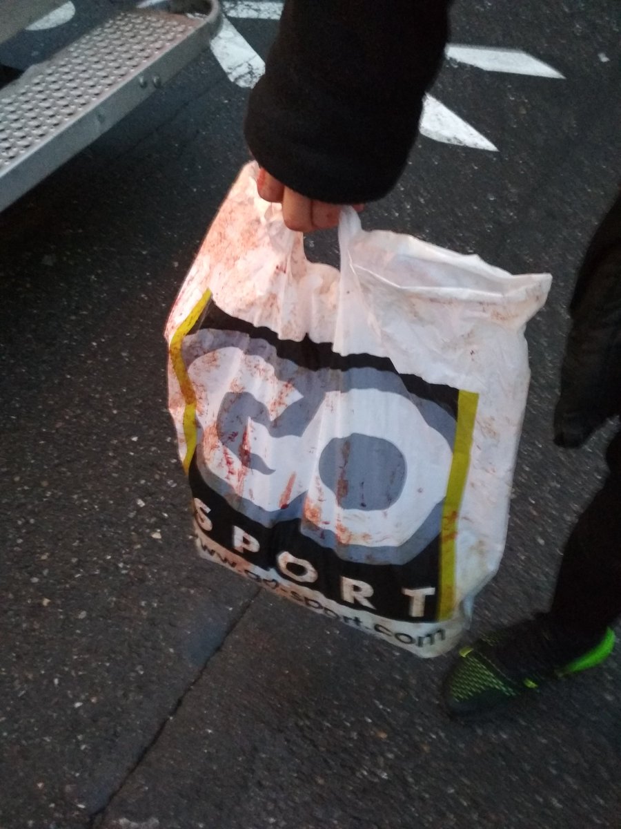 Strasbourg aujourd'hui, un gamin de 15 ans venu faire du shopping s'est fait exploser la joue devant moi #GiletsJaunes #ActeIX #Macron #MacronDemission #Acte9 #RIC