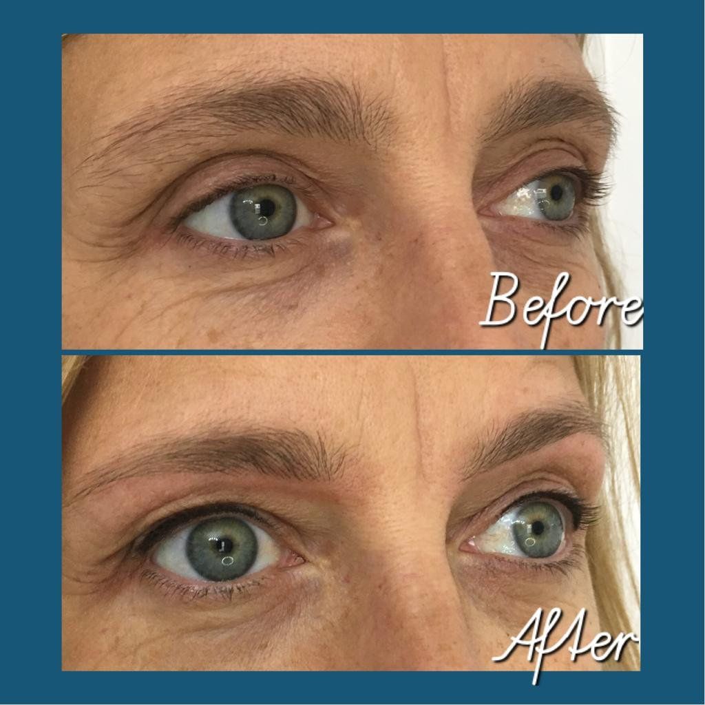 raedenman_'s tweet photo. Are you too busy to apply makeup in the mornings, or no time for re applying makeup in the day? Do you still want to look natural? Getting ready for the no makeup, made up look!
#permanentmakeup #eyeliner #brows #srbrows #reigateclinic #professionalwomen #busywomen #lipliner https://t.co/jVfMeVFULs