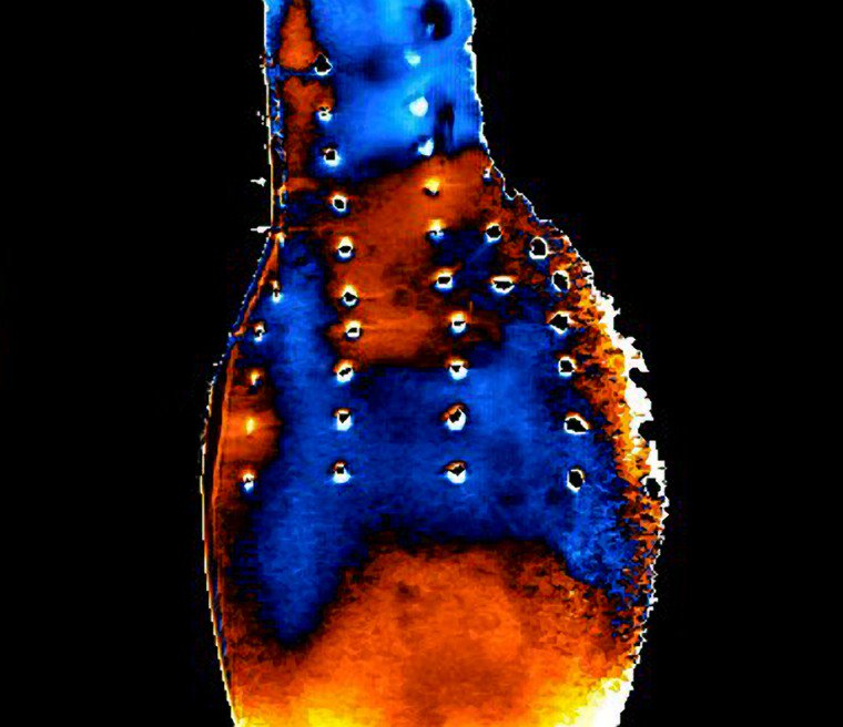 vascularis's tweet image. And some historical #AAA wall stress imaging @wellcomeimages
wellcomecollection.org/works/vjfqem4e