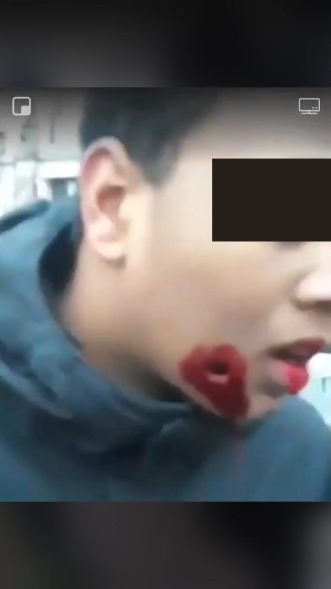 Obs_Violences's tweet photo. Nous demandons #JusticePourLilian, 15 ans, la mâchoire réduite en bouillie par un tir policier alors qu'il faisait les soldes, hier à Strasbourg. @CCastaner @Place_Beauvau @Defenseurdroits https://t.co/ddy8wlCRE6