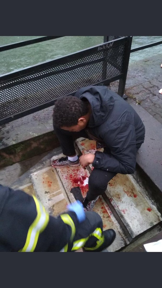 Obs_Violences's tweet photo. Nous demandons #JusticePourLilian, 15 ans, la mâchoire réduite en bouillie par un tir policier alors qu'il faisait les soldes, hier à Strasbourg. @CCastaner @Place_Beauvau @Defenseurdroits https://t.co/ddy8wlCRE6