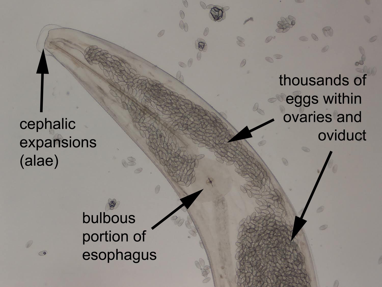 pinworms ezt)