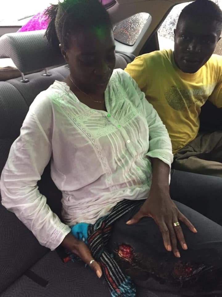 I just spoke to Michele Ndoki who confirmed that she was shot 4 times by a police officer in Douala. She states further that, the police officer was clearly targeting her as he ran a long distant just to shoot her. She is Currently undergoing treatment at a hospital in Douala