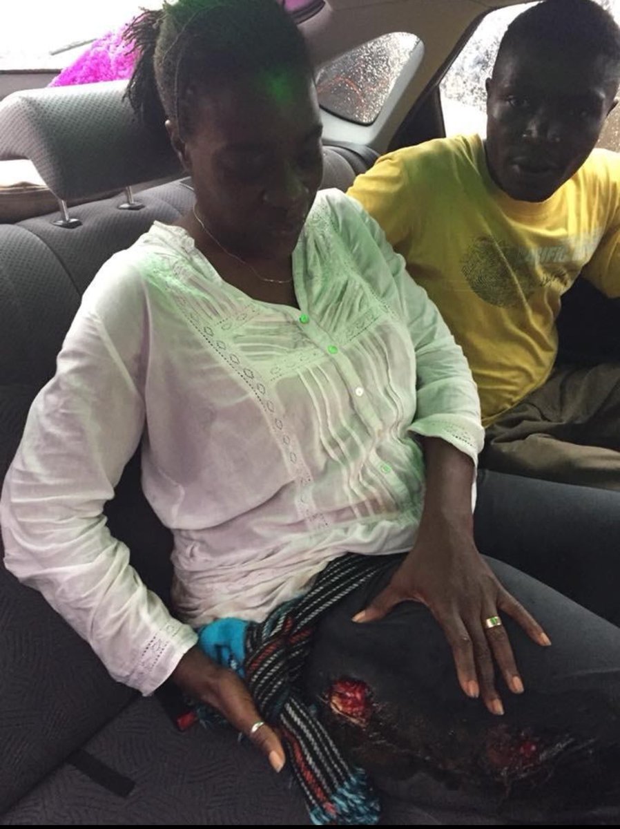 ManeNtali's tweet image. This is the most shocking thing i have seen in the 21st Century. A power and well known Barrister at Law ⁦@MicheleNdoki⁩ respected the constitution of Cameroon and joined protesters to show their dismay on how the country is runned and she was Shot. ⁦@hrw⁩ #dispicable