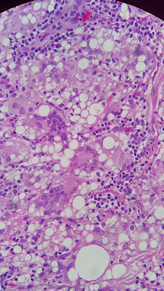 Micropics for all the  #pathtcuriosus &  @ariella8