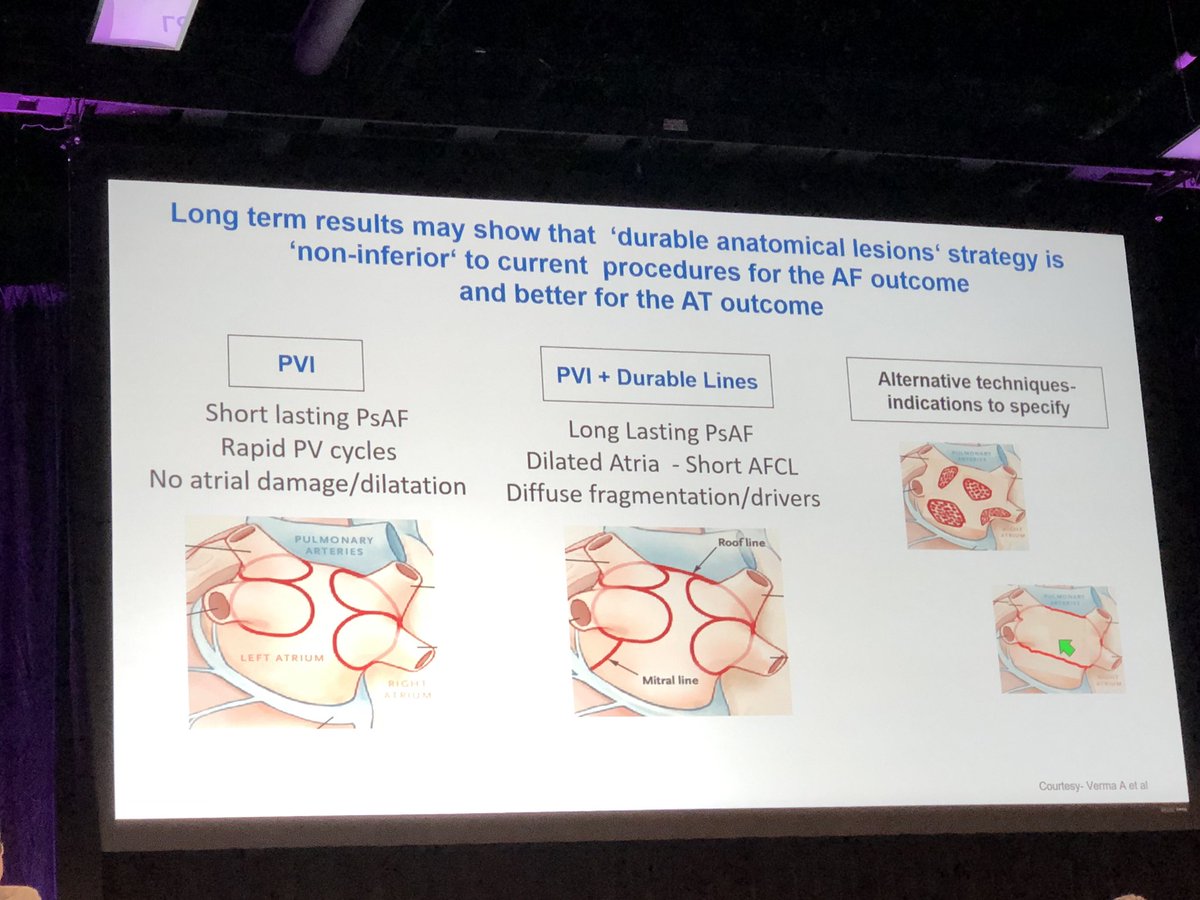 Michel haissaguerre presents great results for persistent af using a pvi, roof line, and complete flutter line approach. Are we now back where we started years ago but with better tools for more permanent lesions. We need another Star AF trial!