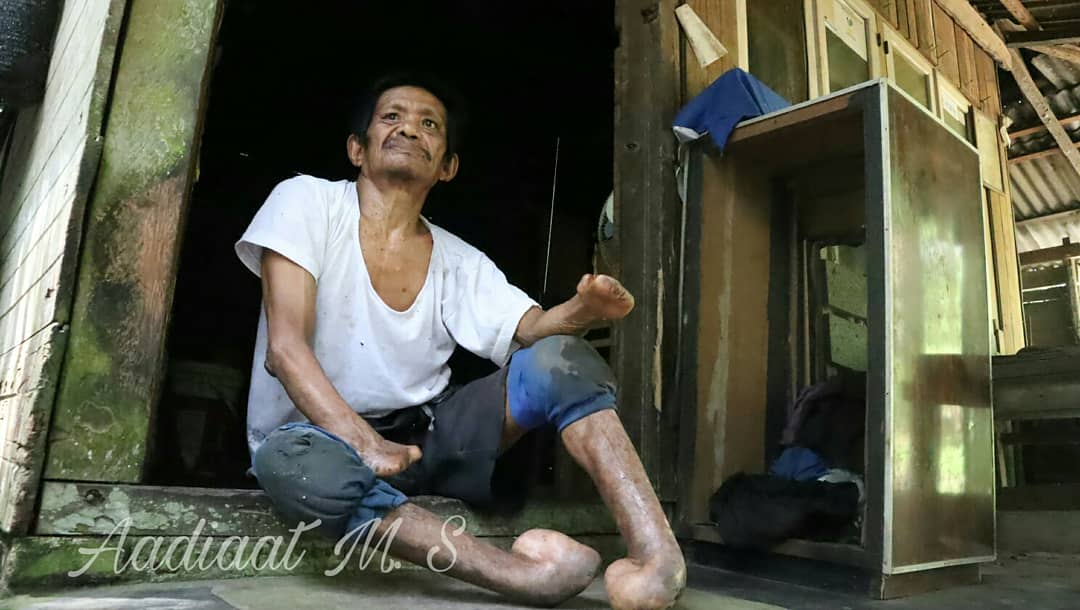 aadiaat_ms's tweet photo. Arifin, mengidap kusta berserta kekurangan fisiknya tetap tabah meskipun tinggal sendirian di rumahnya

https://t.co/dvs3w4xoFl

#harikustasedunia #kusta https://t.co/qrTSiSTdAQ