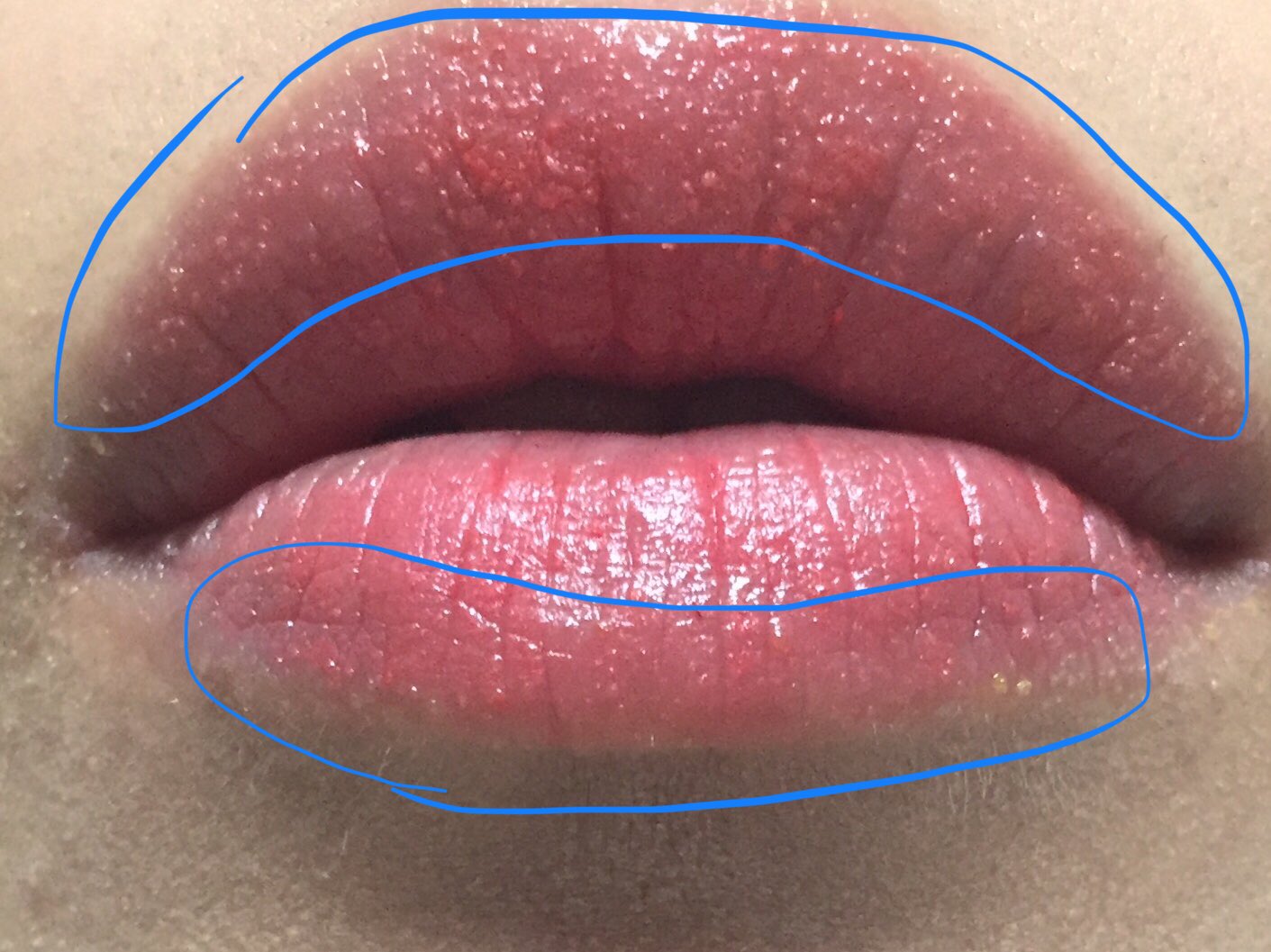 慢性鼻炎 去年の3月の写真 小さなブツブツが写真でも確認できる どんな口紅使っても ブツブツができ 皮が剥けてた D 明太子つけてるわけじゃないよー 皮膚科に行っても 特効薬はないので 軟膏塗るしかないって言われなぁ 唇ブツブツ 唇