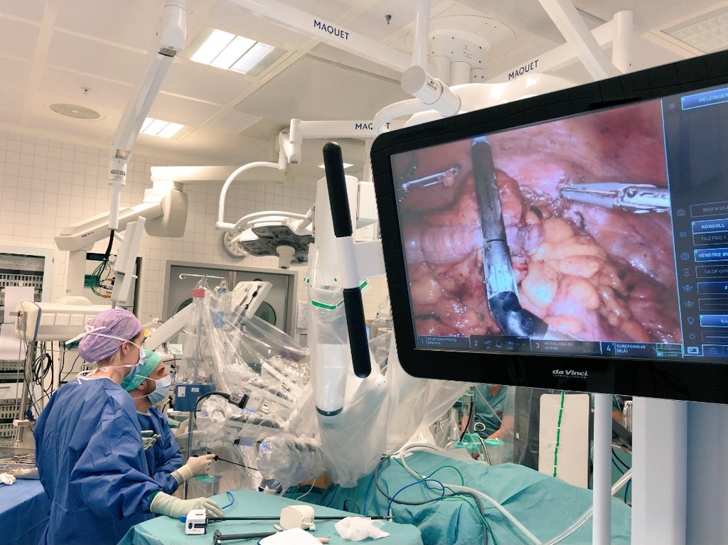 mahirozmen's tweet photo. Stapler transection of left colon using 60mm cartridge from davinci during robotic rectal surgery #colorectalsurgery #SoMe4Surgery #intuitivesurgery @SWexner @juliomayol @ManishChandSurg @Johncalvincoffe @dexexer01 @kolorektal @daVinci_Cerrahi @JavierLuzonMD @BrennanSurgeon https://t.co/3Ffqfn2xav