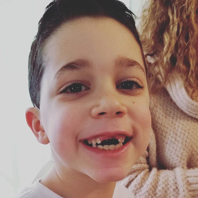 michellearbore's tweet image. Now both his front teeth are gone.
.
.
#SavvySocialMedia #frontteeth #nofrontteeth #toothfairy #losttooth bit.ly/2Thv7aJ