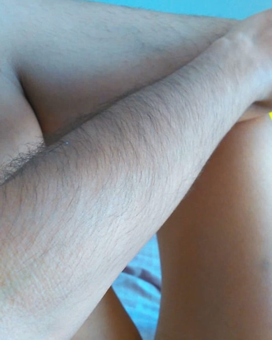 janu_hairy's tweet image. “Thanks to discriminatory comments I grew up full of insecurities. This month I decided to send to hell the knives, wax and everything that has to do with waxing because I FEEL FREE.”

Support Januhairy by donating to the Body Gossip Performance project:

justgiving.com/crowdfunding/b…