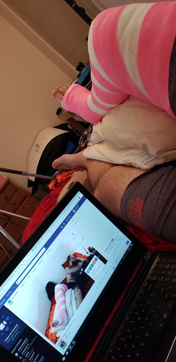 kevinkooljeep's tweet photo. #live #stopasking #Broken #bemyvalentine #pinkcast #mypoortoes #tibiafracture #candicane #signmycast #sports #Spoiler #SpoilerAlert #busted #letsdate #DateMyFamily #dateme #tinder #Chicago #lazysunday #LateNight #saterdaywasfun https://t.co/n1cS8Kaau1