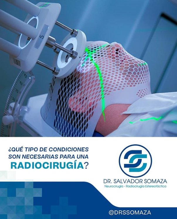 ¿Qué tipo de condiciones son las indicadas para la #Radiocirugía? 👈
 tumores intracraneales, malformaciones vasculares y desórdenes funcionales. Indicaciones potenciales del paciente incluyen Malformaciones Arteriovenosas, Meningiomas, Neurinomas del Acústico, Gliomas.