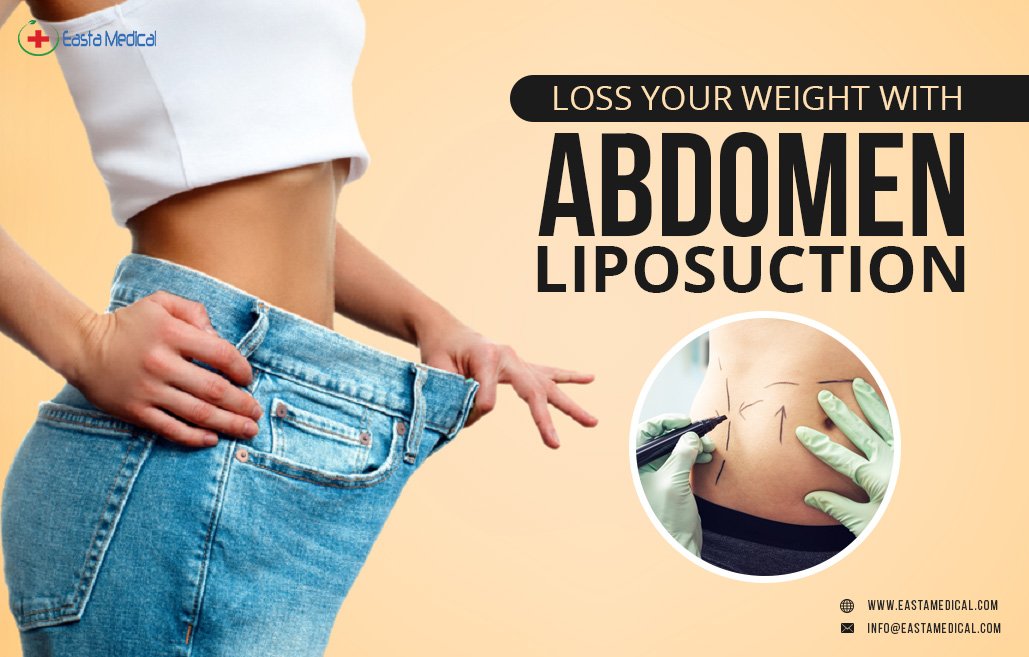 To loss your weight easily with that simple surgery.
Get here: bit.ly/2JGsSMx
#howtosmoothoutstomachafterliposuction
#wherecanyougetliposuction
#liposuctiontoremovefacefat
#abdominaltummytuck
#abdominalliposuctionprice
#upperabdominalliposuctionbeforeafter
#eastamedical