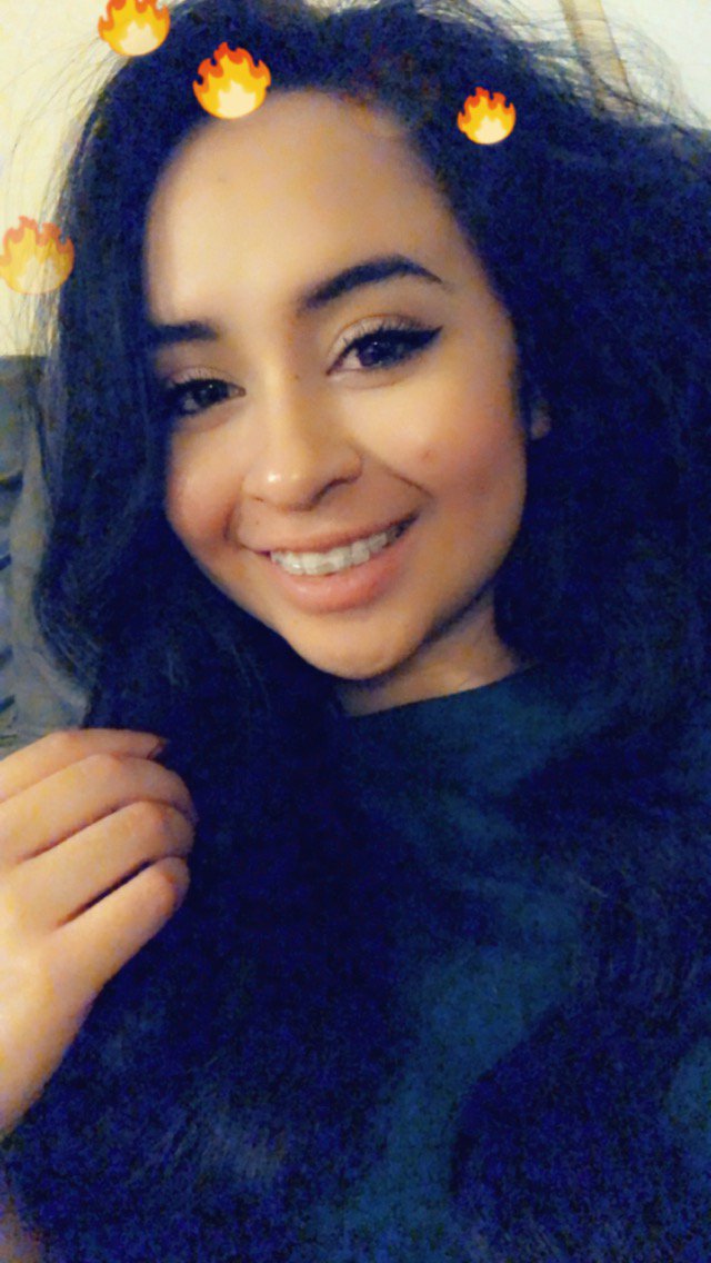 LittleCheb's tweet image. I got braces. So ouch.