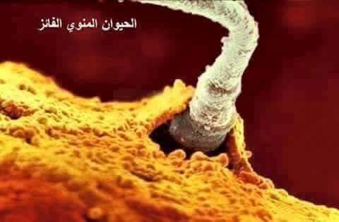 RamyAlSawy1's tweet photo. قصة قصيرة عظيمة عنوانها :

( ثُمَّ خَلَقْنَا النُّطْفَةَ عَلَقَةً فَخَلَقْنَا الْعَلَقَةَ مُضْغَةً فَخَلَقْنَا الْمُضْغَةَ عِظَامًا فَكَسَوْنَا الْعِظَامَ لَحْمًا ثُمَّ أَنشَأْنَاهُ خَلْقًا آخَرَ فَتَبَارَكَ اللَّهُ أَحْسَنُ الْ��َالِقِين ).

. https://t.co/qrLnIBNDbz
