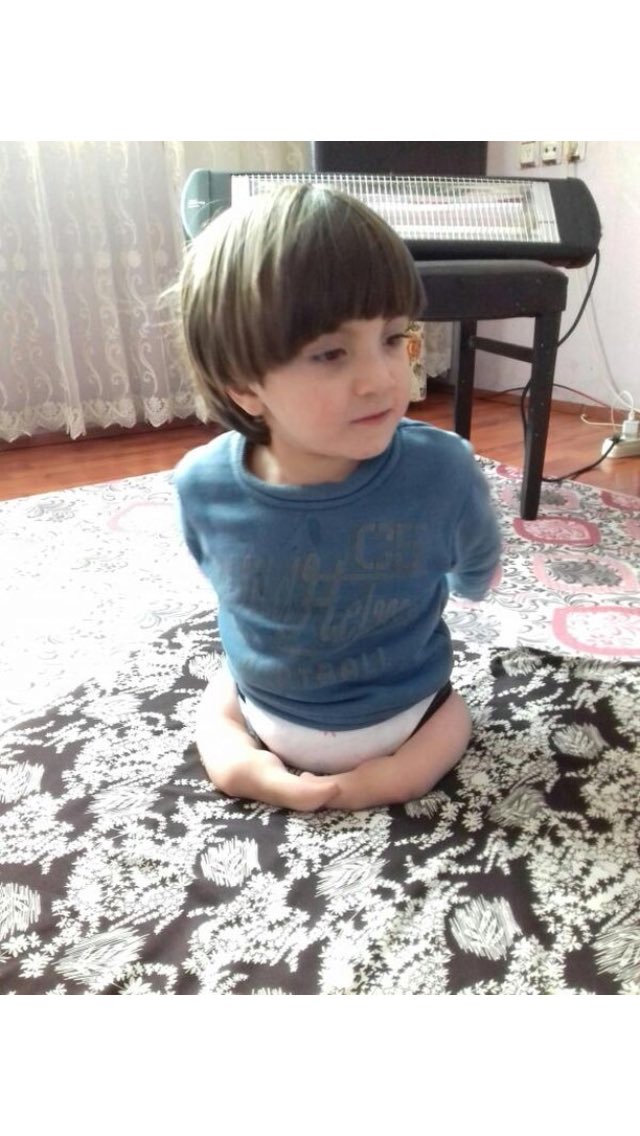 Baran yalçın 4 yaşında. Ağrı patnos’da yaşıyor. Baran’a protez bacak takılmazsa ilerde çok daha zor yürüyecek. ailenin maddi desteğe ihtiyacı var..Durumları yok. Duyarlı olan insanların bu konuda desteği olacağını düşünüyorum,yardımcı olur musunuz? <a href="/Haydi_Ahbap/">Haydi Ahbap</a> <a href="/haluk_levent/">Haluk Levent</a>