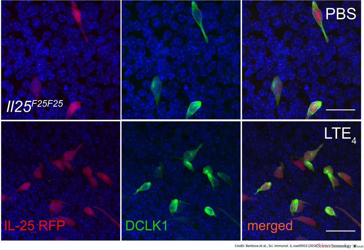 Cousins of #taste cells in the mouth, brush cells in the airway passages can play an active role in big inflammatory responses, in conditions such as #asthma, found a <a href="/BrighamWomens/">Brigham and Women's Hospital</a>, <a href="/SciImmunology/">Science Immunology</a> study: bit.ly/2On3Vs5 ($)