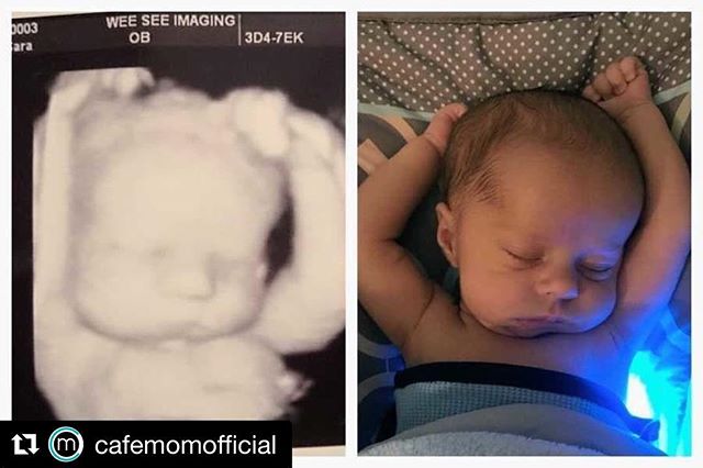 March_for_Life's tweet image. Science continues to prove that we are the same person inside and out. ❤ #uniquefromdayone #whywemarch