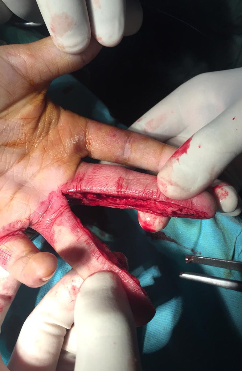 mansurahmadshah's tweet photo. And thn GOD made #Surgeons
#KPdoctors https://t.co/f5Dx4IjtIC