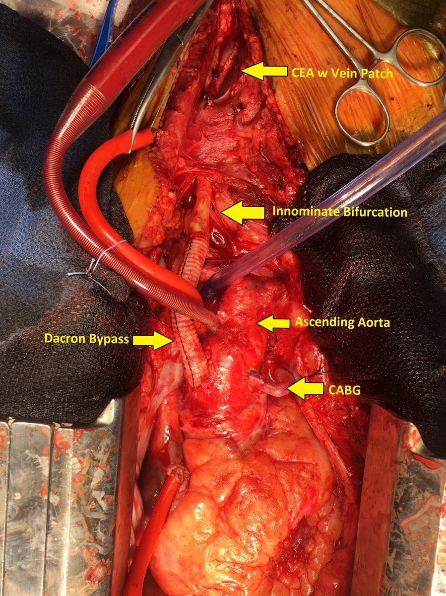 Eric Endean tweet media