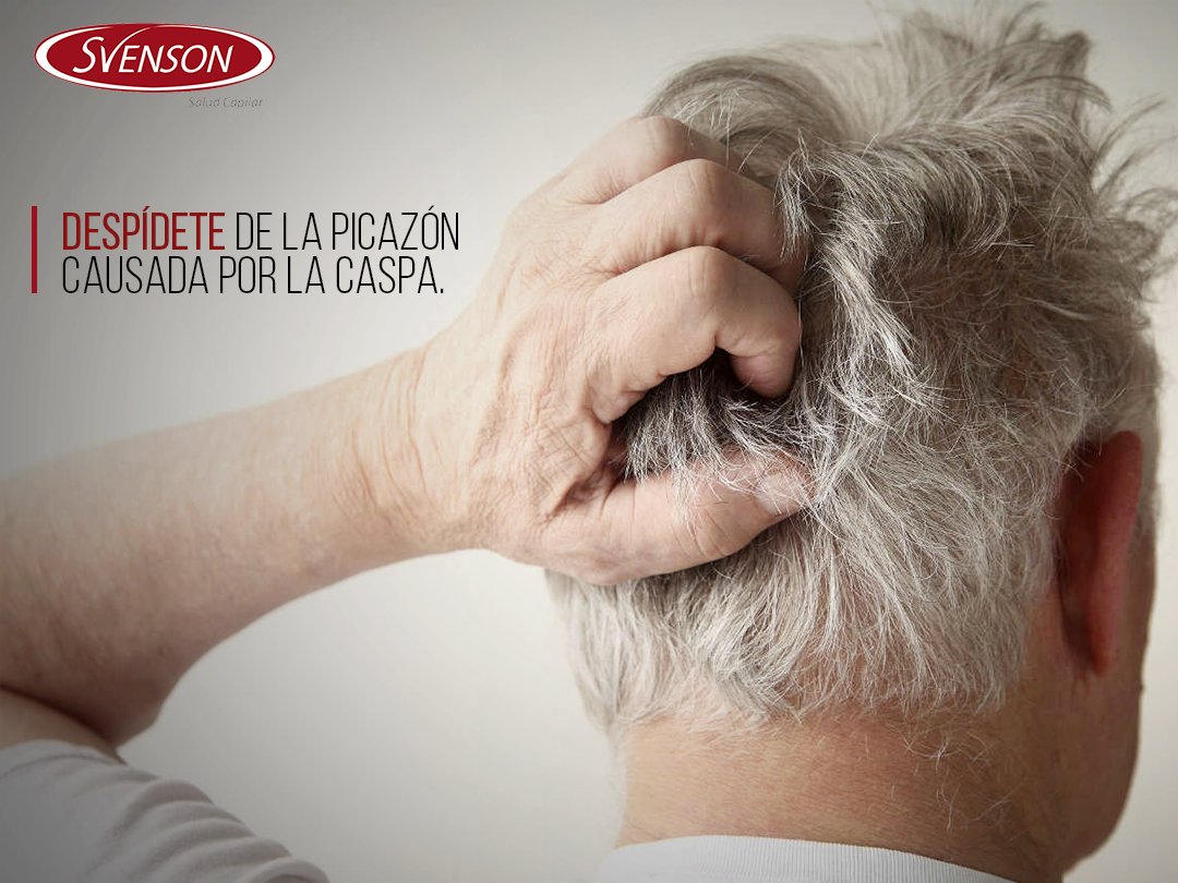 Svensonmexico's tweet photo. La comezón ocasionada por la #caspa puede convertirse en un problema mayor cuando se produce infección y esta misma produce mal olor en el #cuerocabelludo.
Realiza el siguiente #testcapilar y descubre la mejor solución para ponerle fin al problema ➡➡➡https://t.co/ZUAijXiPG5 https://t.co/DW9fXUYdvR