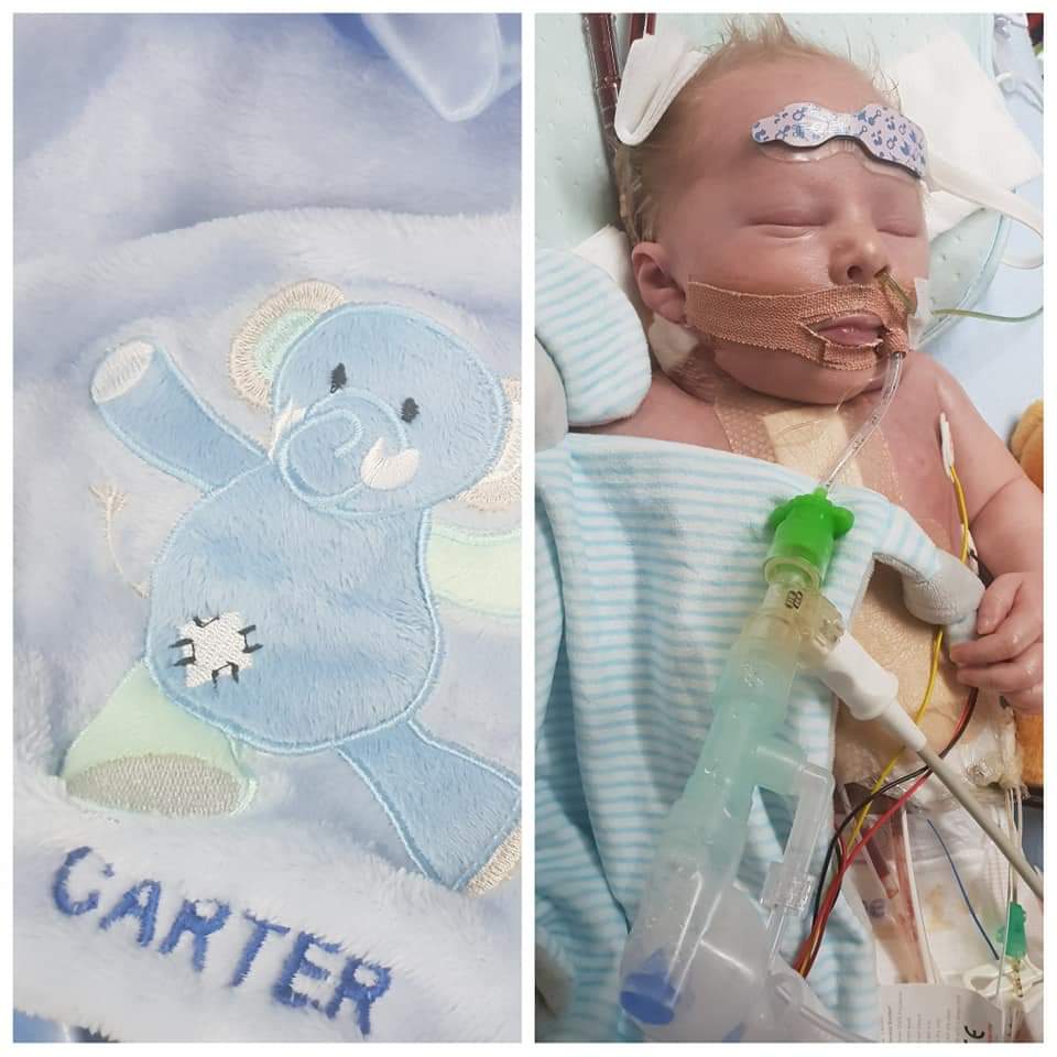 _dylanwood's tweet photo. 💙💙💙URGENT UPDATE💙💙💙

Doctors are now predicting 3 days to find a heart due to complications with his Ecmo machine.

Please please please share 

#findaheartforcarter

@Faye_Tozer
@_ClaireRichards
@LSLofficial
@llatchfordevans
@Ianhwatkins
@OfficialSteps
@kylieminogue https://t.co/w3R86pldVl