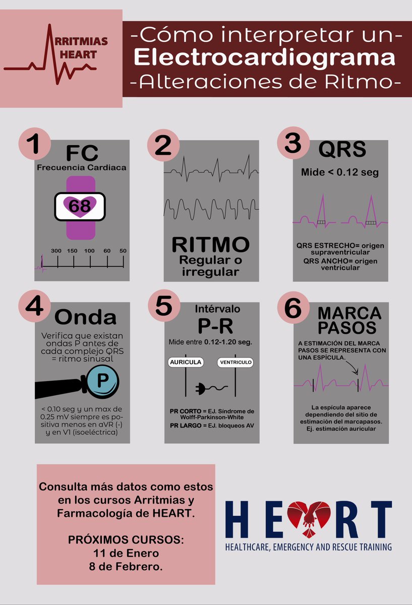 CentroHeart's tweet photo. ¿Sabes cómo interpretar #Arritmias en #EKG?
#MeLateHEART https://t.co/lDg8I5I5HR