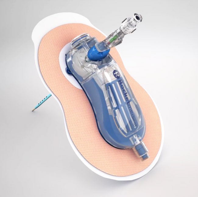 MarciniakLab's tweet photo. Another patient recruited today at @CUH_NHS to #RAMPP study of ambulatory treatment of #pneumothorax
@naj_rahman @OxfordRespTrial https://t.co/mdTAmuafcD