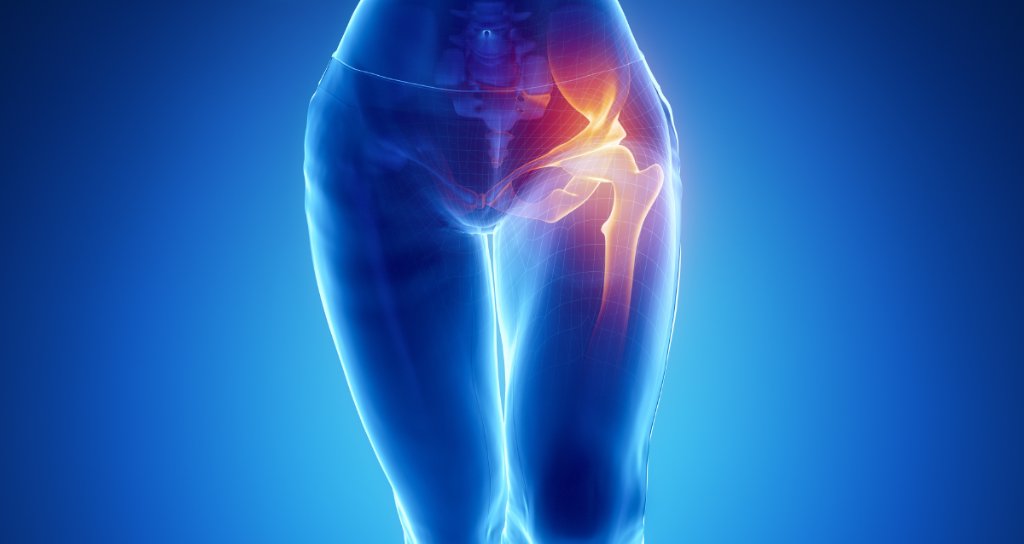WebMD's tweet photo. For every 10 pounds of extra body weight you carry, there’s an added 50 pounds of pressure on your hips and knees. https://t.co/zoAe0iXDYv https://t.co/UFndQr4cNu