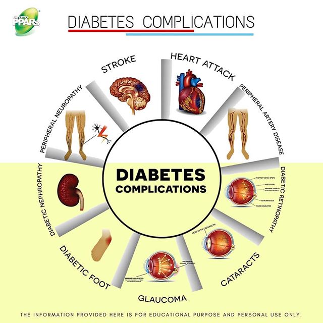 cryptopparsmy's tweet photo. Facts about Diabetes #5 👨‍⚕💡
Diabetes Complications
Do visit our website for more information:
🌐 https://t.co/st97voN2vN   
🌐 https://t.co/EwmGoV0lWT   
#cryptoppars #cryptopparsmalaysia #cryptopparsmy #crypto #ppars #cryptomonadales #chlorellasorokinianaW87 https://t.co/d16fQuJ1BA