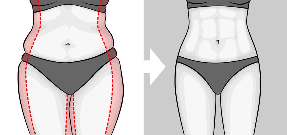 SamnangToshio's tweet photo. #Miniliposuction is usually done in very specific areas of the body, like:
➡️The underarms.
➡️The inner thighs.
➡️The upper abdomen.
➡️Love handles
More details: https://t.co/eoG3zFN9Zk
#miniliposuctionabdomen
#minilipokorea
#miniliposuctionkorea
#miniliposuction
#365mcglobal https://t.co/REG13OYW9e