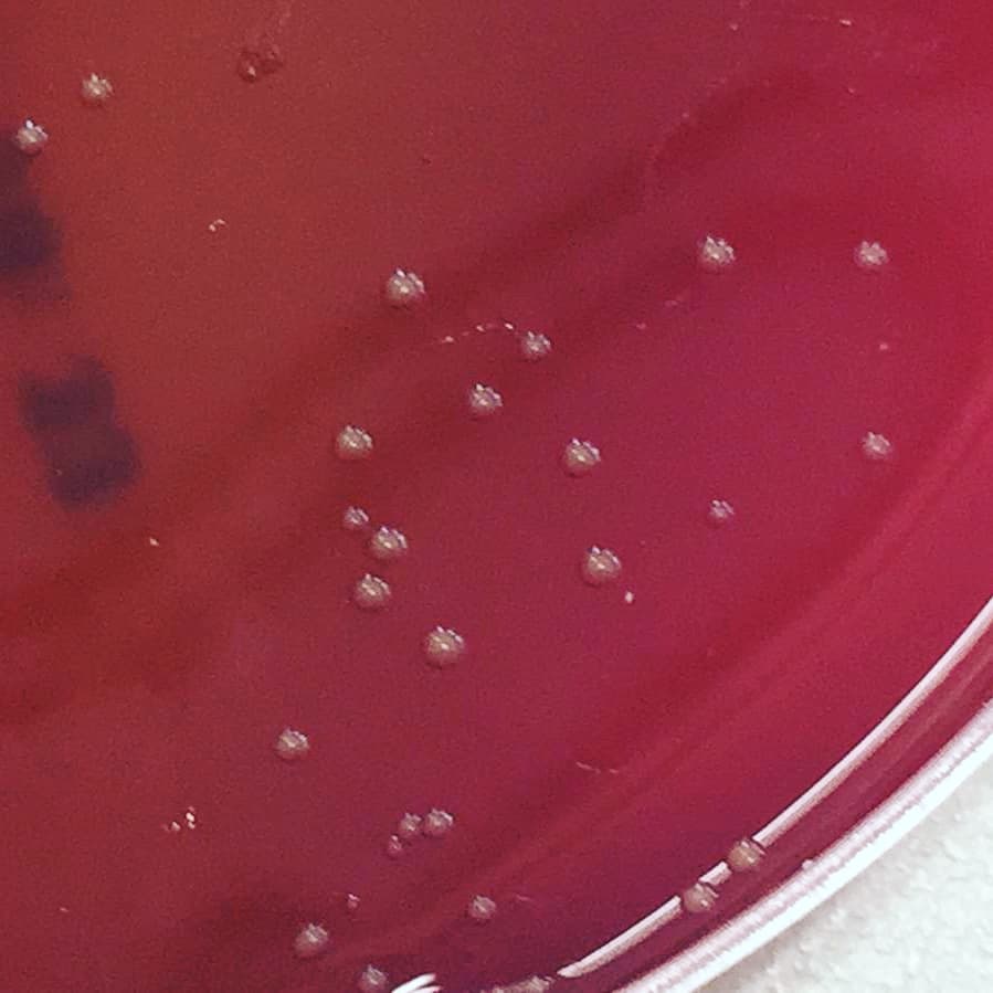 PadreDamianSSCC's tweet photo. Què hi ha al nostre 👃? I a la nostra 👅? I als 🦶 i 🖐️? Aquí teniu una mostra dels cultius 🧫 que han fet els alumnes de #biologia de #2nbtxpd! #microbiology #microbiologia #aprendrefent #femciència https://t.co/y8qRM43S9P