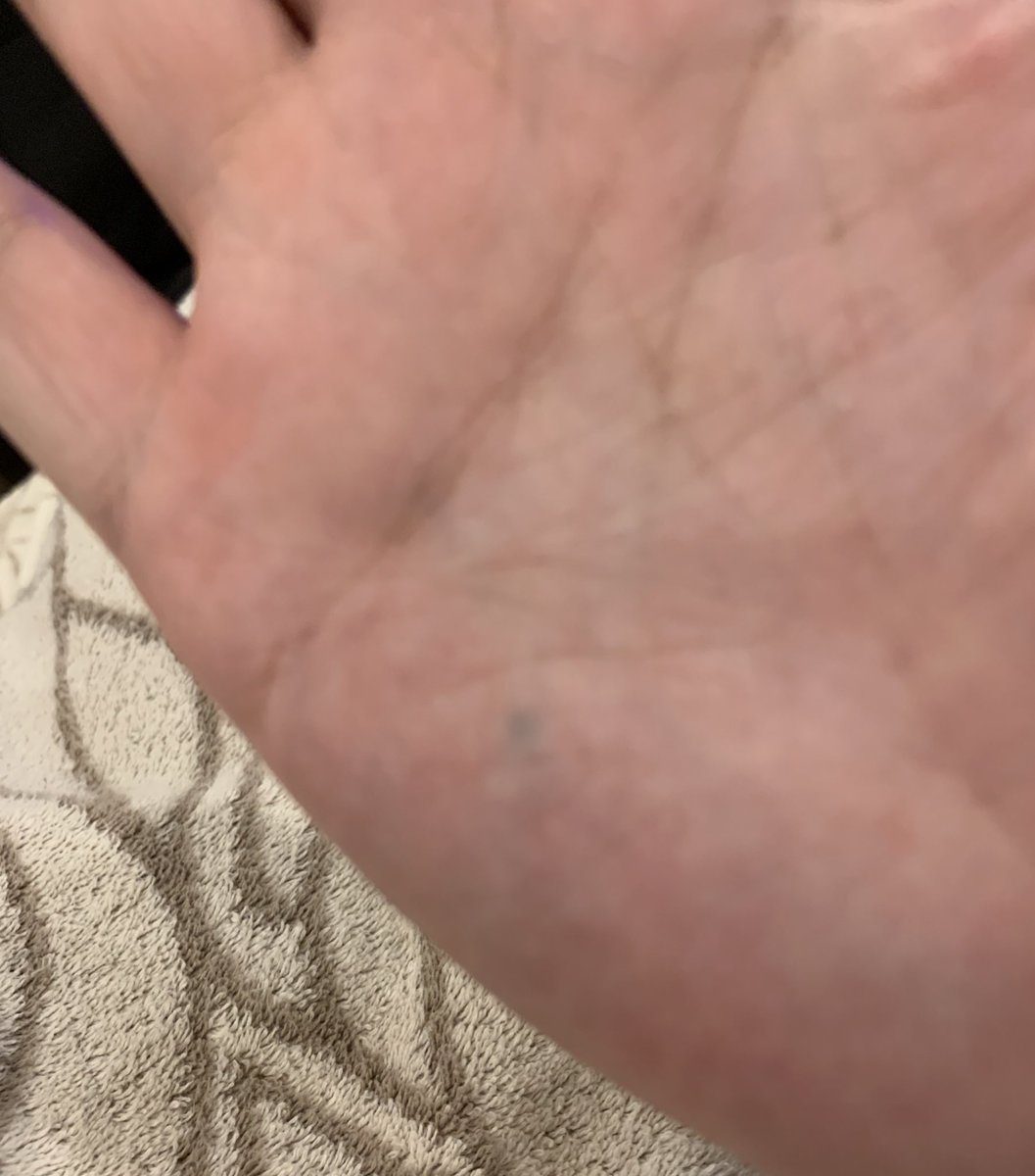 刃 不満 謝罪 鉛筆が手に刺さった Social Fitness Jp