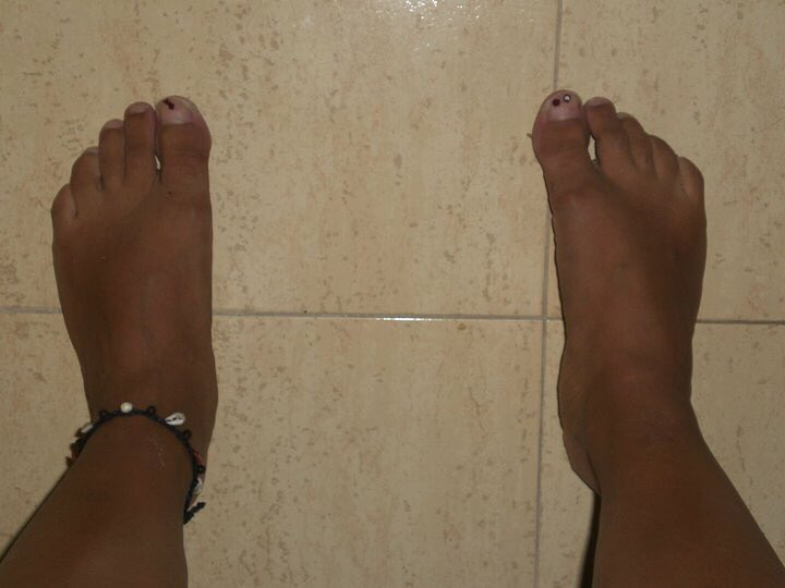 Pippipat's tweet photo. I got into #10YearChallenge #Patpie #Patfoot https://t.co/ukWTUNcdHq