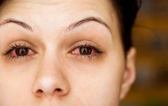 clinicalasik's tweet photo. Descartan que #derrameocular cause problemas de #visión https://t.co/uBCX2rxlNt https://t.co/unMSyPLf3x