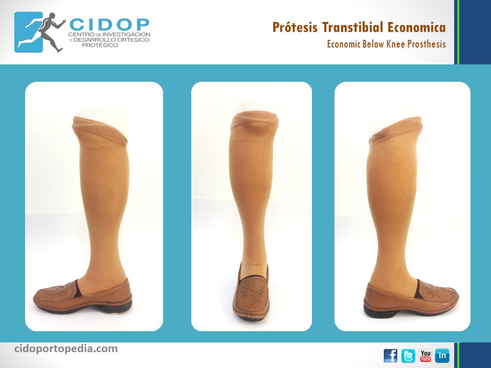 CIDOPortopedia's tweet photo. Prótesis transtibial
Below knee prosthesis
#protesis #transtibial #ortopedica #bajorodilla #ortopedia #cidop
#belowknee #prosthesis #bk #orthopedic https://t.co/o8FdcB9FMj