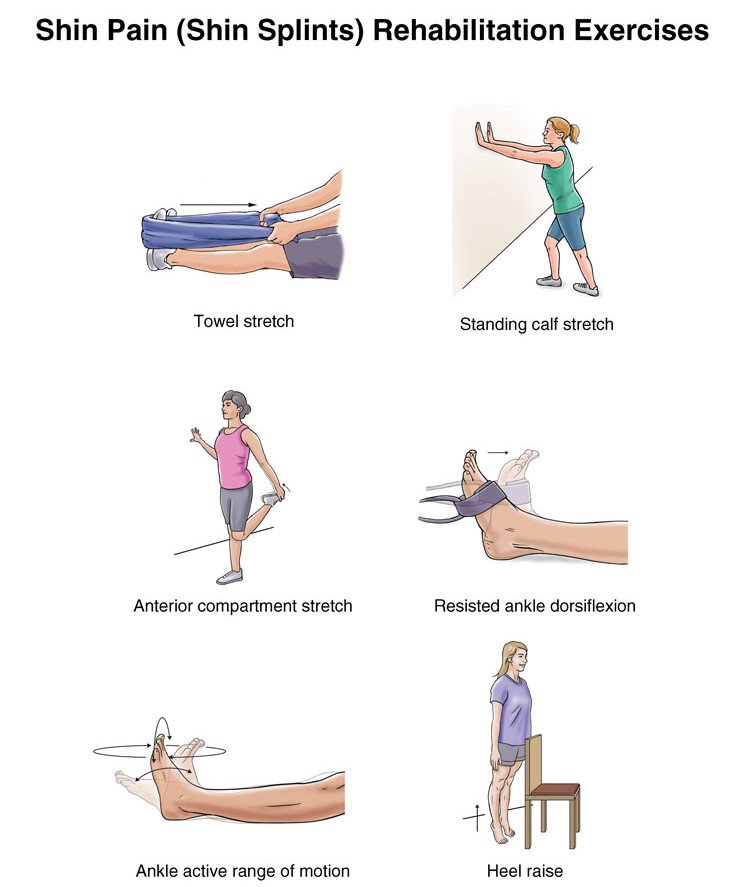 up2speedCA's tweet photo. Do your shins throb and ache after your daily run or just sprinting to catch the bus? It could be shin splints.
#shinsplints #shinpain #mostcommoninjury #chirocanhelp #drSanchez #chiropracticcare #up2speed #mfr #muscleflossingtechnique #painrelief #painfree https://t.co/V3iWlFQFJY