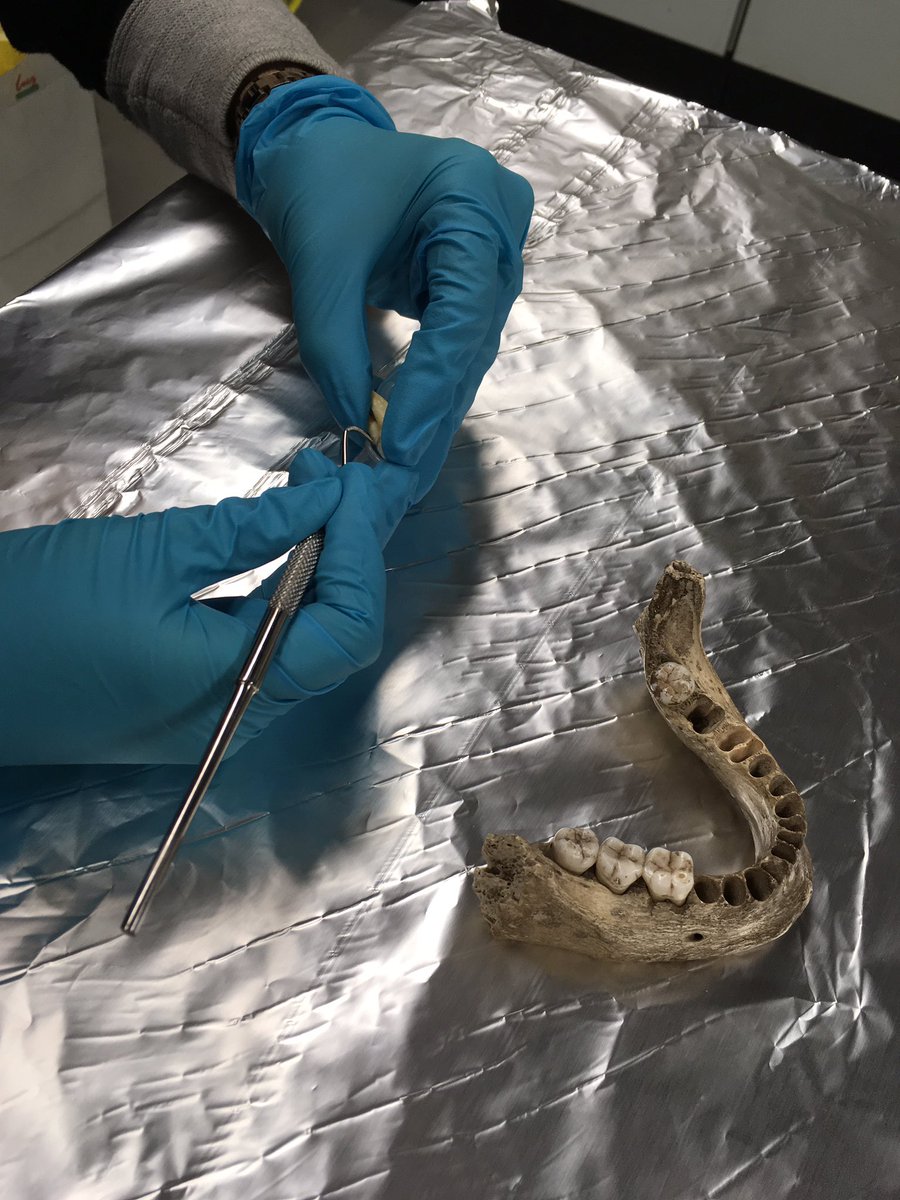 <a href="/SophyCharlton/">Sophy Charlton</a> and I have been busy sampling dental calculus for <a href="/upnorthproject/">UP-North Project</a> Hoping for some exciting #aDNA and #proteomic results