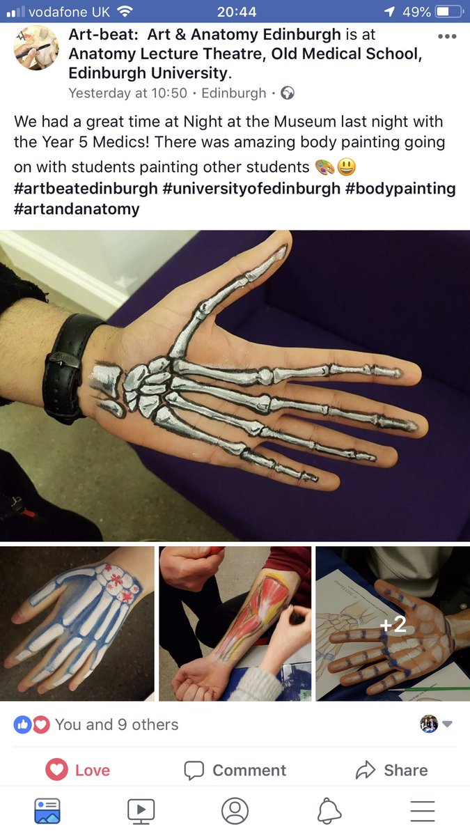 #artandanatomy helped me conceptualise anatomy in 2D and 3D while at @EdinUniMedicine - great to see this @EdinburghUni group enjoying the same! facebook.com/18183527150967…