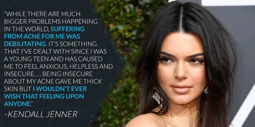 E! News on Twitter "Kendall Jenner is proactively opening up about her(01)